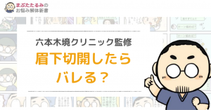 眉下切開をしたらバレる 整形顔になりたくないアナタのために