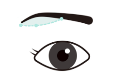 眉下切開イメージ01