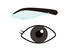 眉下切開イメージ02