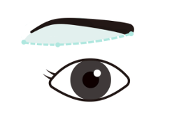 眉下切開イメージ03